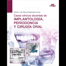 Casos Clínicos Docentes de Implantología, Periodoncia y Cirugía Oral