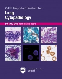 WHO Reporting System for Lung Cytopathology. 1st Edition, Volume 1