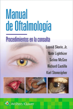 Manual de Oftalmología. Procedimientos en la Consulta