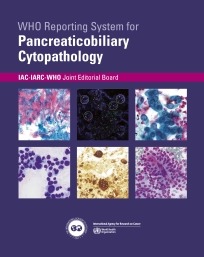 WHO Reporting System for Pancreaticobiliary Cytopathology. 1st Edition, Volume 2