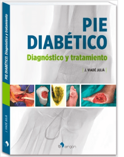 Pie Diabético. Diagnóstico y Tratamiento
