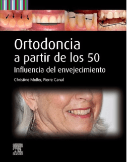 Ortodoncia a Partir de los 50. Influencia del Envejecimiento