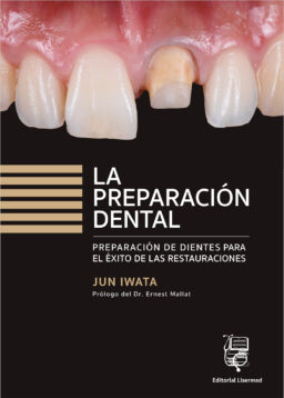 La preparación dental Preparación de dientes para el éxito de las restauraciones – Jun Iwata