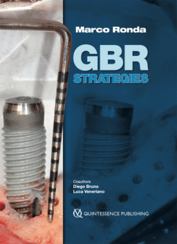 GBR Strategies