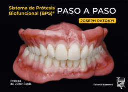 Sistema de Prótesis Biofuncional (BPS)® Paso a Paso