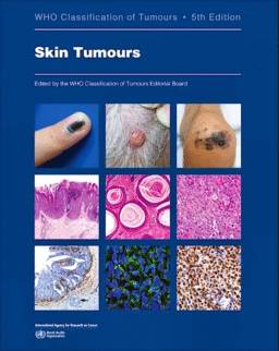 Skin Tumours (WHO Classification of Tumours, Vol. 12)
