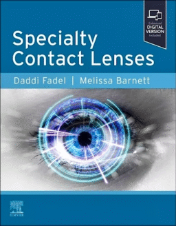 Specialty Contact Lenses