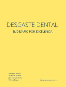 Desgaste Dental. El Desafío por Excelencia