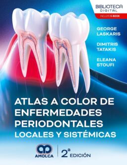 Atlas a Color de Enfermedades Periodontales Locales y Sistémicas
