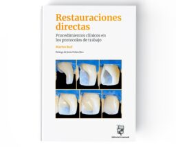 Restauraciones directas. Procedimientos clínicos en los protocolos de trabajo