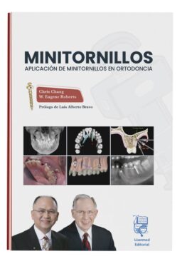 MINITORNILLOS Aplicación en ortodoncia