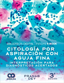 Citología por Aspiración con Aguja Fina. Interpretación para Diagnósticos Acertados
