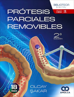Prótesis Parciales Removibles – 2ª Edición