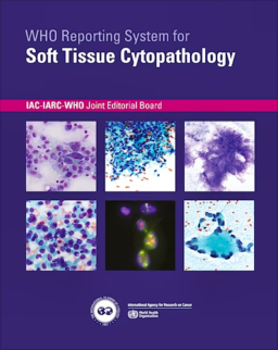 WHO Reporting System for Soft Tissue Cytopathology | Atlas de citopatología de tejidos blandos