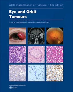 WHO Classification of Tumours: Eye and Orbit Tumours Vol. 13