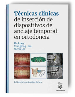 Técnicas clínicas de dispositivos de anclaje temporal en ortodoncia – Hu Long | Xiaolong Han | Wenli Lai