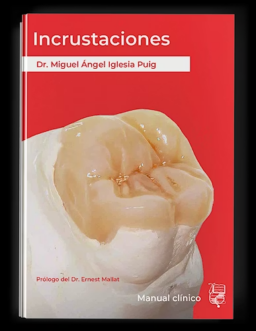 PREPARACION Y CEMENTADO DE INCRUSTACIONES DENTALES
