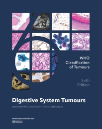 Digestive System Tumours WHO Classification of Tumours, 6th Edition, Volume 1
